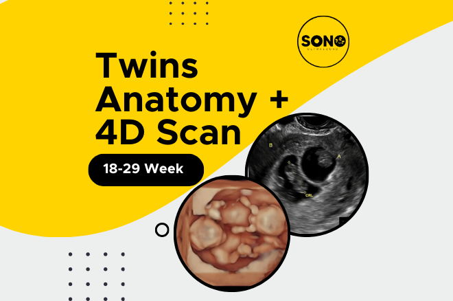 Twins Anatomy 4D Scan Malaysia