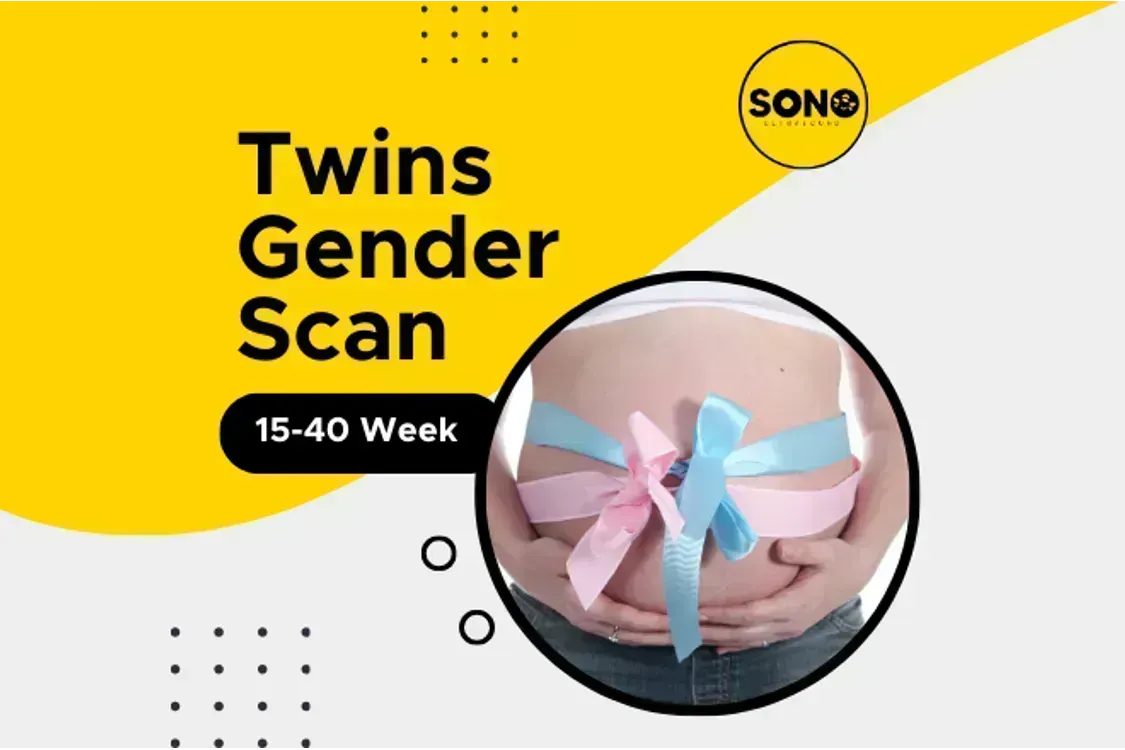 Twins Gender Scan