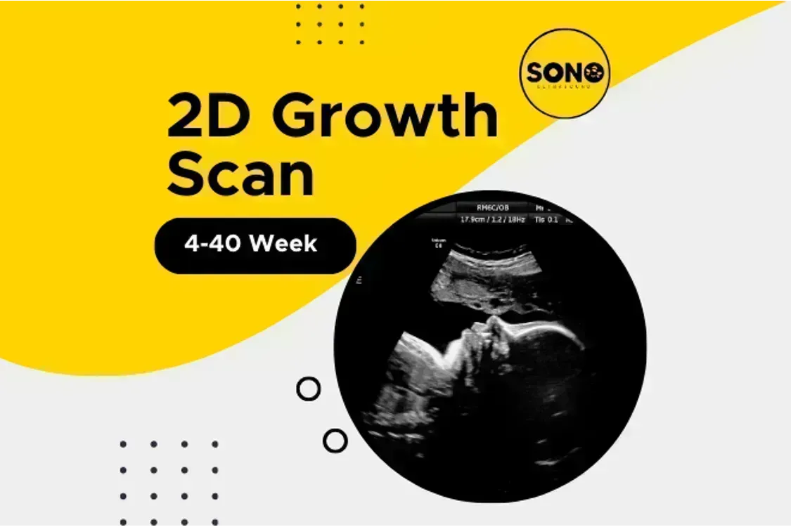 2D Growth Scan Malaysia