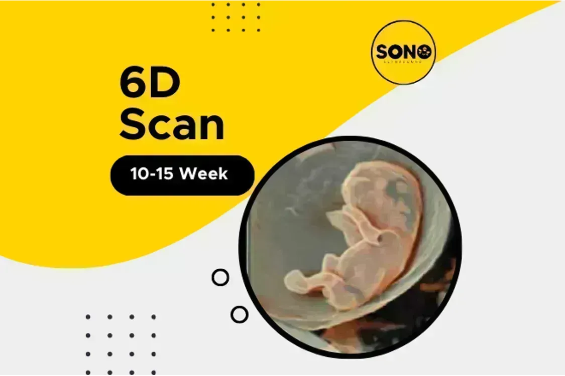 6D Baby Scan